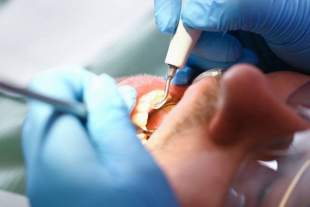 Best Emergency Wisdom Teeth Removal in Eddyville, IA