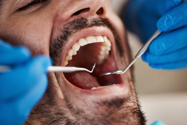 Best Urgent Care for Lost Fillings or Crowns in Eddyville, IA